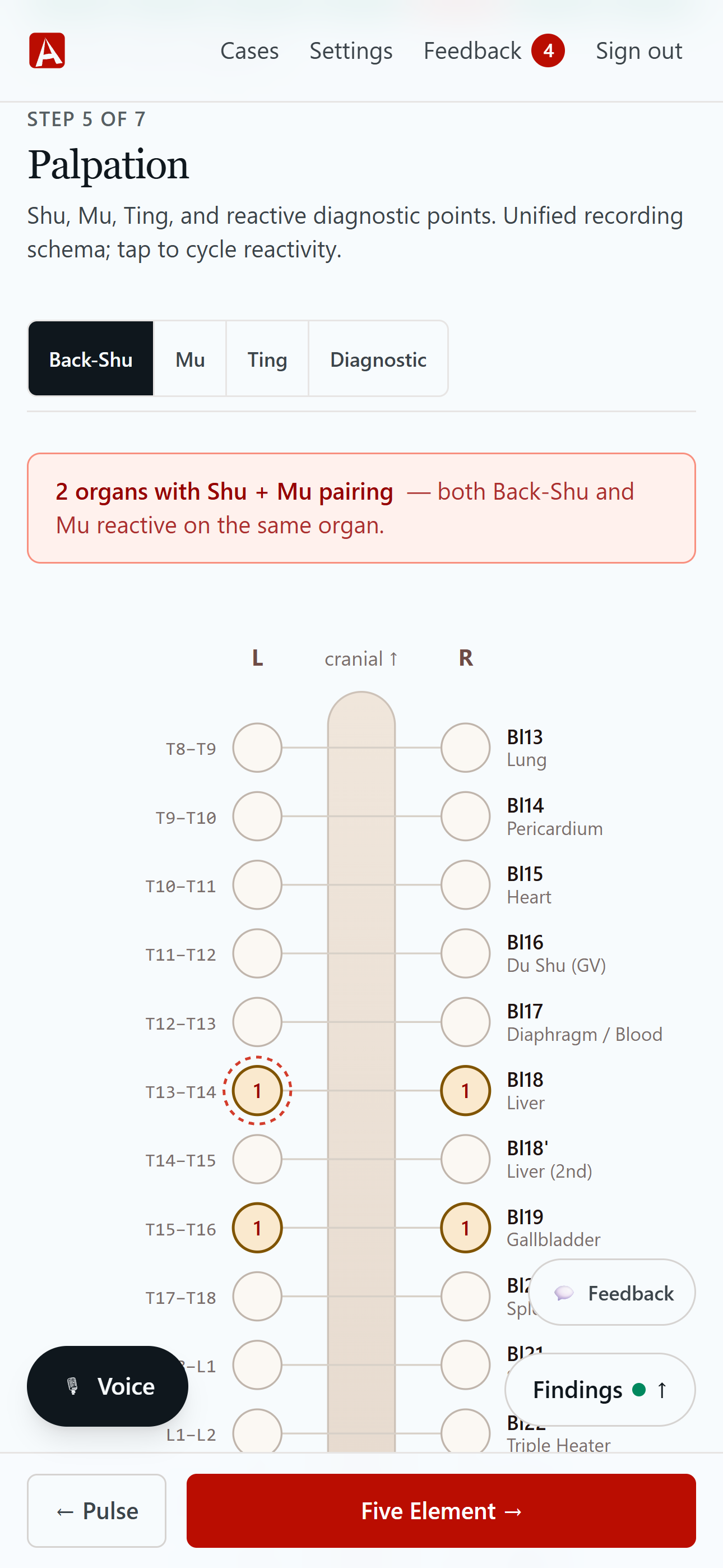 A case open in AnimaChart on a phone: a step page with the live findings panel.