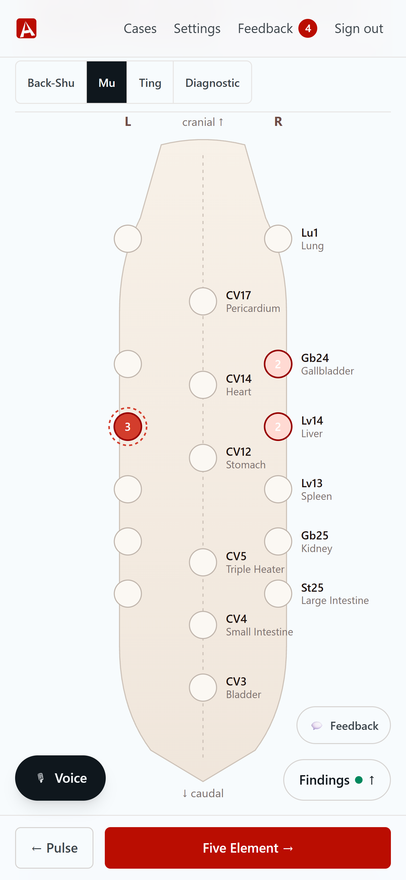 AnimaChart's palpation step: the Back-Shu dorsal spine diagram with reactivity and a Shu+Mu pairing banner.