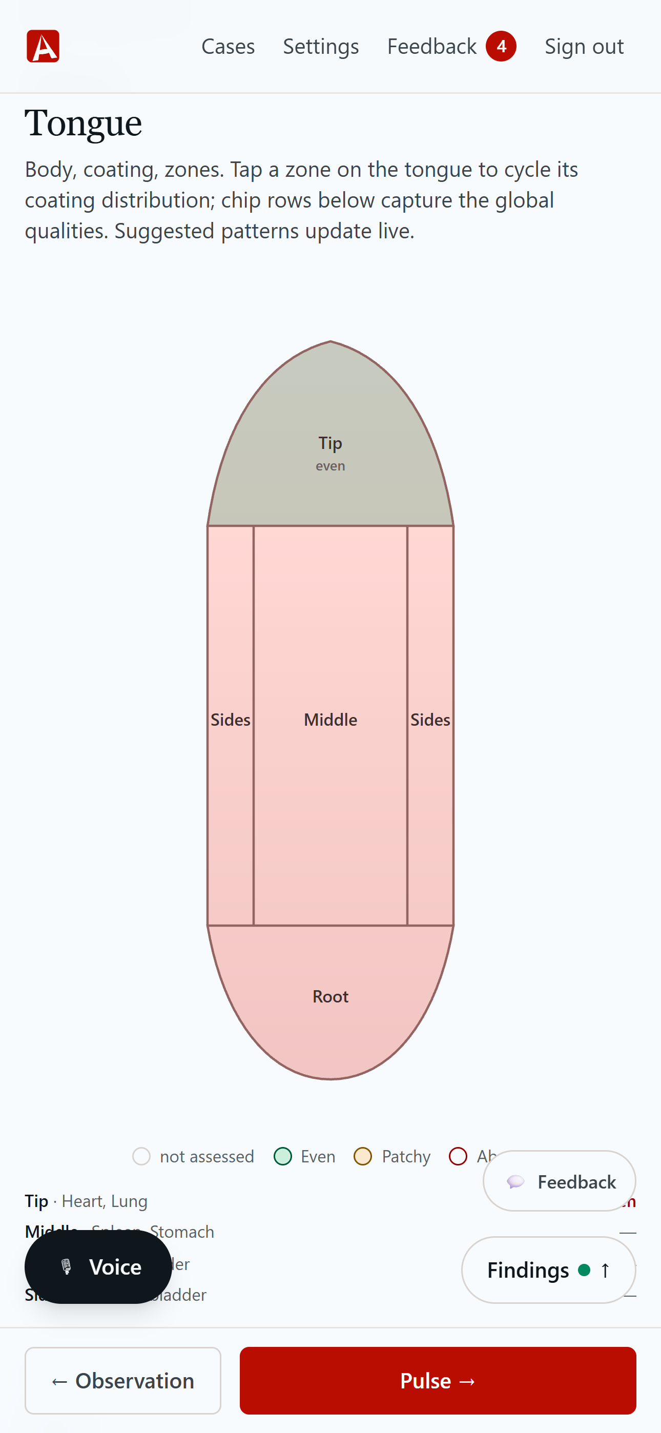 AnimaChart's tongue step: a four-zone tongue diagram with global qualities.